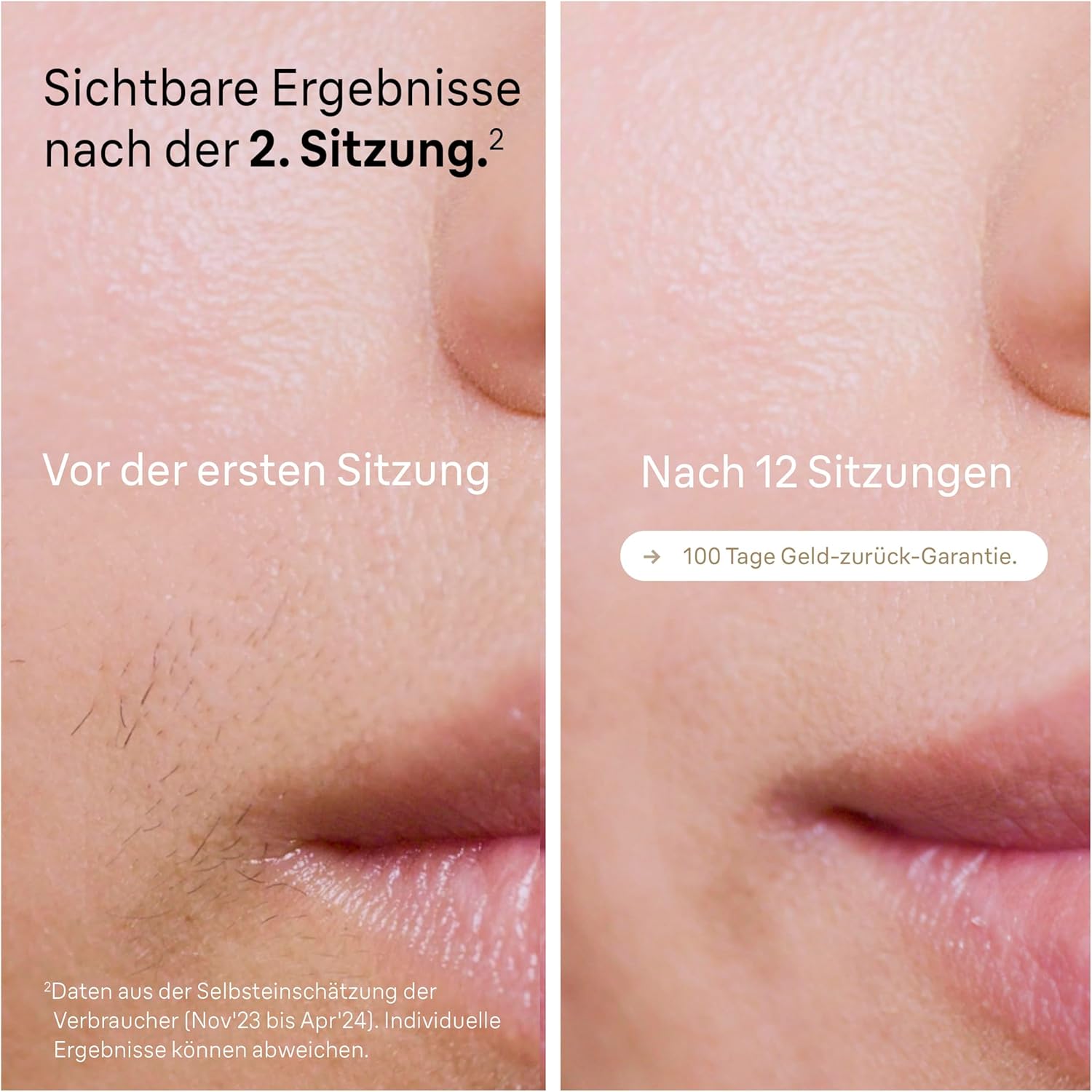 Braun IPL Silk·expert Pro 5 PL5358 – IPL Haarentfernungsgerät, Dauerhafte und Schmerzfreie Haarentfernung für Zuhause – inkl. Etui, Venus Rasierer, 4 Aufsätze, Designed in Germany –  Weiß/Gold