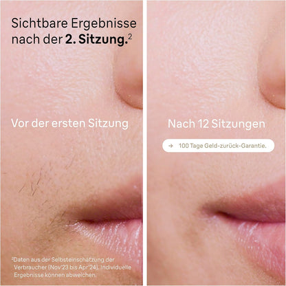 Braun IPL Silk·expert Pro 5 PL5358 – IPL Haarentfernungsgerät, Dauerhafte und Schmerzfreie Haarentfernung für Zuhause – inkl. Etui, Venus Rasierer, 4 Aufsätze, Designed in Germany –  Weiß/Gold